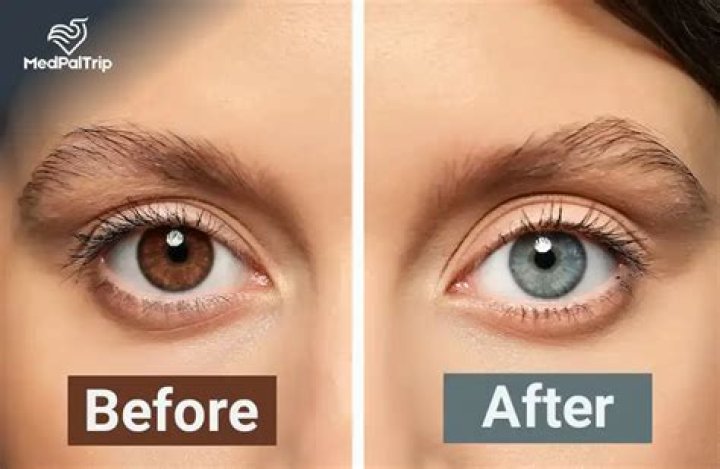 Do eyes change colour before death?